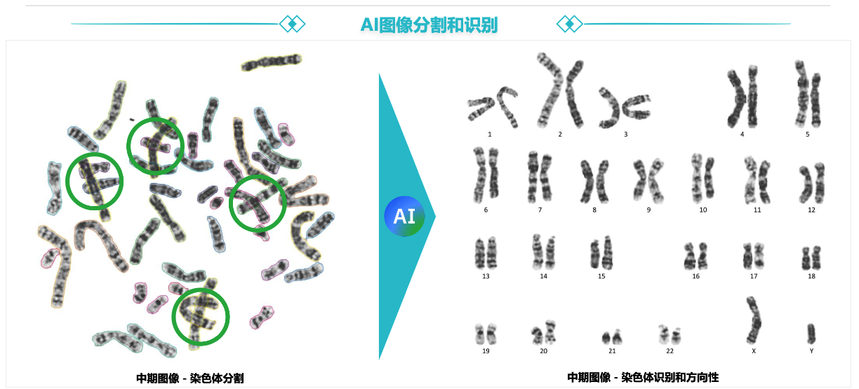 某三甲医院遗传科-染色体核型分析