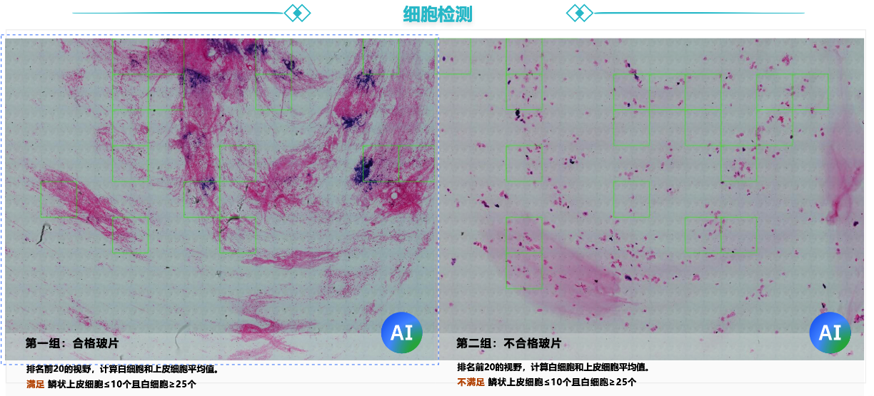 某三甲医院细菌检测案例